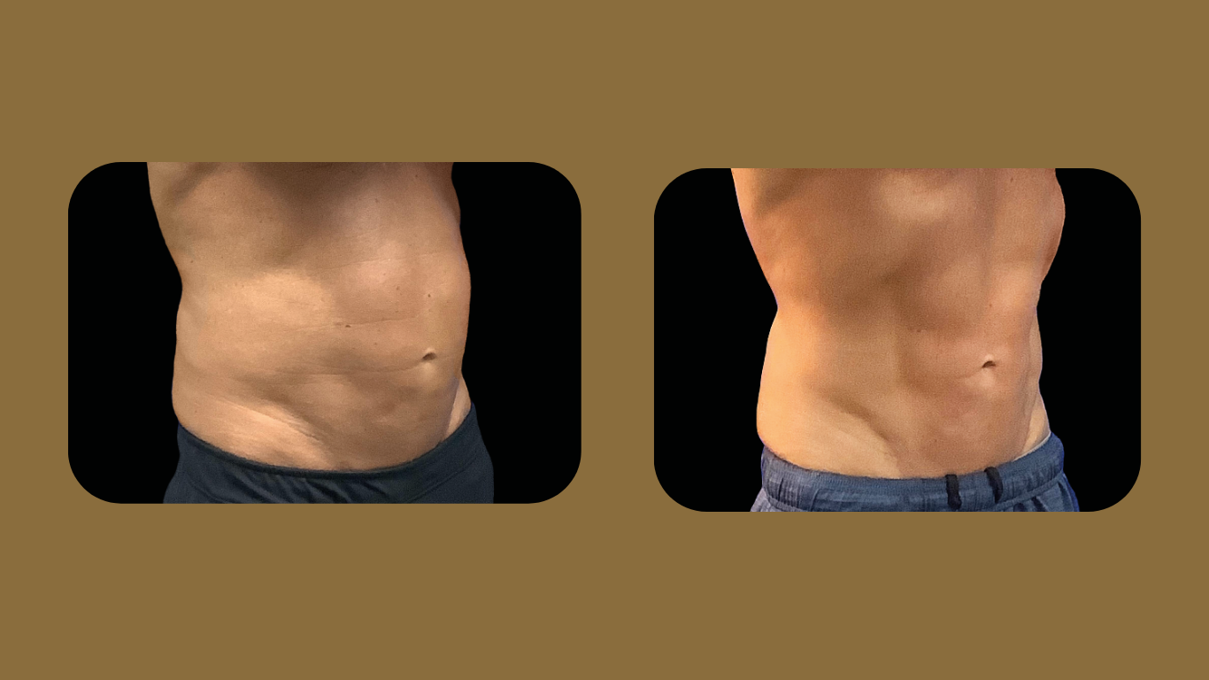 Before And After Result 